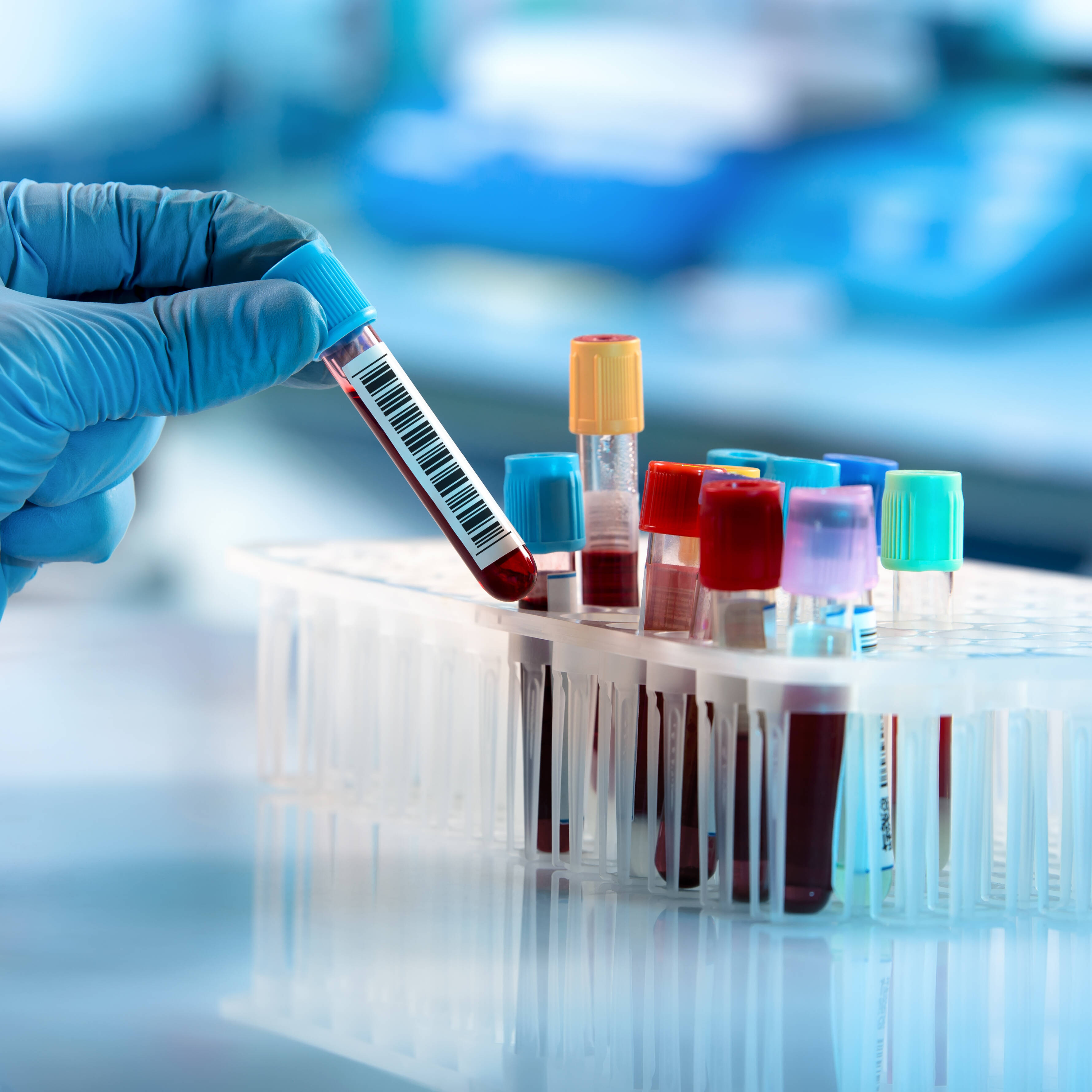 Doctor,hand,taking,a,blood,sample,tube,from,a,rack